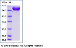 Sino Biological Recombinant Mouse Nectin-1/PVRL1 Protein (ECD, hFc Tag),