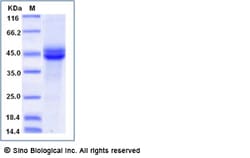 Sino Biological Mouse PLA2G2D / Phospholipase A2 IID Protein (Fc Tag) 100ug,
