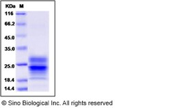 Sino Biological Recombinant Ferret IFN gamma Protein (His Tag), Quantity: