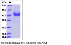 Sino Biological Rabbit NGFR / TNFRSF16 / P75 Protein (ECD, His Tag) 50ug,