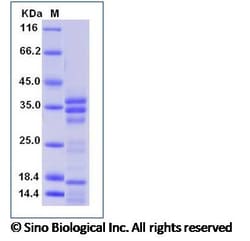 Sino Biological Recombinant Dermatophagoides pteronyssinus Der p 1 Protein