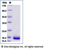 Sino Biological Recombinant Dermatophagoides farinae Der f 2 Protein (His