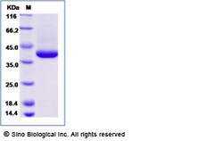 Sino Biological Blomia tropicalis Blot1 Protein (His Tag) 250ug, Quantity: