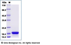 Sino Biological Recombinant Blomia tropicalis Blo t 2 Protein (His Tag),