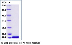 Sino Biological Recombinant Blomia tropicalis Blo t 5 Protein (His Tag),