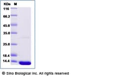 Sino Biological Recombinant Blomia tropicalis Blo t 21 Protein (His Tag),