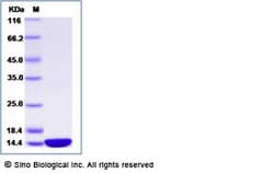 Sino Biological Recombinant Blomia tropicalis Blo t 21 Protein (His Tag),
