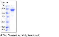 Sino Biological Recombinant Canine TIM-1/HAVCR1 Protein (mFc Tag), Quantity: