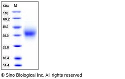 Sino Biological Recombinant Canine TIM-1/HAVCR1 Protein (His Tag), HPLC-verified,