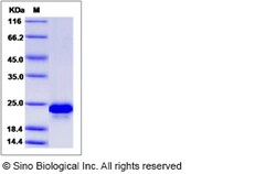 Sino Biological VEGF164 Protein, Canine, Recombinant, Quantity: Each of