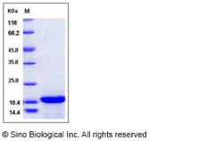 Sino Biological Recombinant Canine IL-33 Protein, Quantity: Each of 1