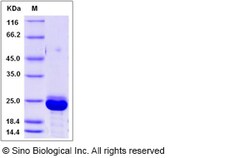 Sino Biological Recombinant Canine RBP4 Protein (His Tag), Quantity: Each