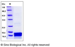 Sino Biological Canine IL21 / Interleukin 21 Protein 20ug, Quantity: Each