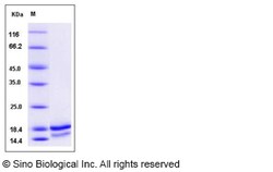 Sino Biological Recombinant Canine IL-5 Protein (His Tag), Quantity: Each