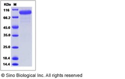 Sino Biological Recombinant Canine Her2/ERBB2 Protein (His Tag), HPLC-verified,