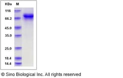 Sino Biological Canine Carbonic Anhydrase IX / CA9 Protein (Fc Tag) 20ug,