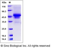 Sino Biological Recombinant Canine Carbonic Anhydrase IX/CA9 Protein (His