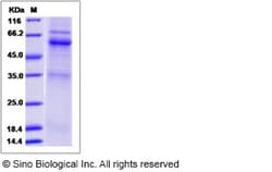 Sino Biological Recombinant Canine Angiopoietin-like 7 Protein (hFc Tag),