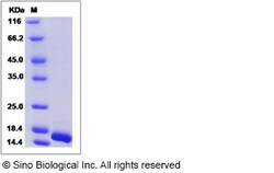 Sino Biological Recombinant Canine FGF1 Protein, Quantity: Each of 1