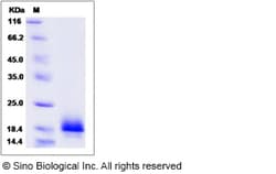 Sino Biological Recombinant Canine ACVR1 Protein (His Tag), Quantity: Each