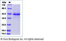 Sino Biological Recombinant Canine PDGF-A Protein (hFc Tag), Quantity: