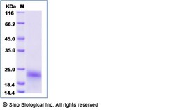 Sino Biological Recombinant Canine PDGF-B Protein (His Tag), Quantity: