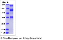 Sino Biological Canine HGF / Hepatocyte Growth Factor Protein 50ug, Quantity: