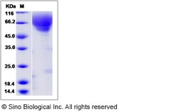Sino Biological Canine Fractalkine / CX3CL1 Protein 50ug, Quantity: Each