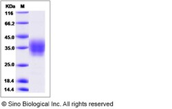 Sino Biological Recombinant Canine Ephrin B2 Protein (His Tag), Quantity: