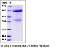 Sino Biological Recombinant Canine IL-11RA/IL-11R alpha Protein (hFc Tag),
