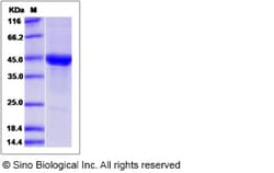 Sino Biological Recombinant Canine IL-11RA/IL-11R alpha Protein, Quantity: