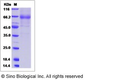 Sino Biological Recombinant Canine IL-20R alpha/IL-20RA Protein (hFc Tag),