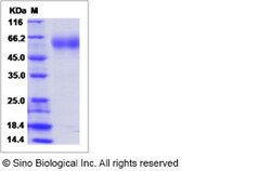 Sino Biological Canine IL18R1 Protein (ECD, His Tag) 100ug, Quantity: Each
