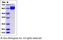Sino Biological Recombinant Canine IL1R2 Protein (hFc Tag), Quantity: Each
