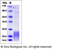 Sino Biological Recombinant Canine Lymphotactin/XCL1/SCYC1 Protein (His