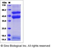 Sino Biological Recombinant Canine TGF beta 2 Protein (His Tag), Quantity: