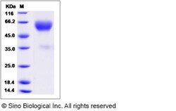 Sino Biological Recombinant Canine TrkA Protein (hFc Tag), Quantity: Each