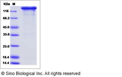 Sino Biological Recombinant Canine IL17RD Protein (hFc Tag), Quantity: