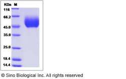 Sino Biological Recombinant Canine IL17RD Protein (His Tag), Quantity:
