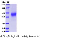 Sino Biological Recombinant Canine CD2 Protein (His Tag), Quantity: Each