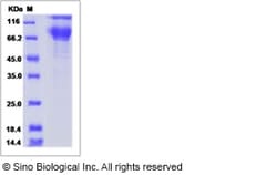Sino Biological Recombinant Canine PD-L1/B7-H1 Protein (ECD, hFc Tag),