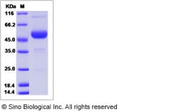 Sino Biological Canine CTLA-4 / CD152 Protein (ECD, Fc Tag) 100ug, Quantity: