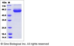 Sino Biological Recombinant Canine FOLR1 Protein (hFc Tag), Quantity: Each