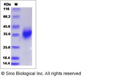 Sino Biological Recombinant Canine FOLR1 Protein (His Tag), Quantity: Each