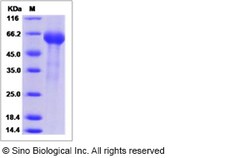 Sino Biological Canine IL-6R / CD126 Protein (ECD, His Tag) 100ug, Quantity: