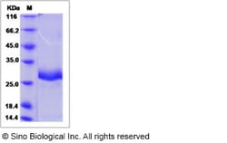 Sino Biological Recombinant Canine IGFBP1 Protein (His Tag), Quantity: