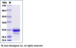 Sino Biological Recombinant Canine Can f 1 Protein (His Tag), Quantity: