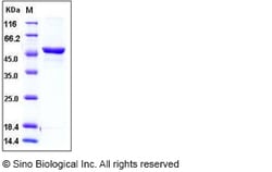 Sino Biological Rat GPT1 / GPT Protein (His Tag) 10ug, Quantity: Each of
