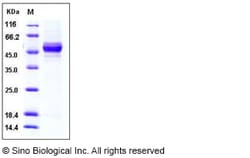 Sino Biological Recombinant Rat GPT2 Protein (His Tag), Quantity: Each