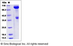 Sino Biological Recombinant Rat c-MET/HGFR Protein (hFc Tag), Quantity:
